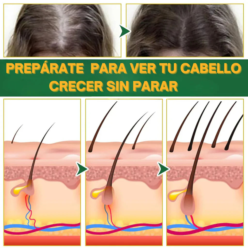 Ouhoe - Tu elixir mágico para el crecimiento del cabello⭐⭐⭐⭐⭐