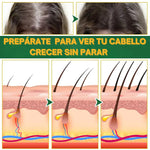 Ouhoe - Tu elixir mágico para el crecimiento del cabello⭐⭐⭐⭐⭐