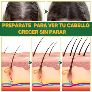 Ouhoe - Tu elixir mágico para el crecimiento del cabello⭐⭐⭐⭐⭐